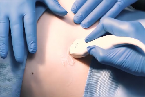 胎兒心臟超聲波檢查在孕17周做合適嗎？